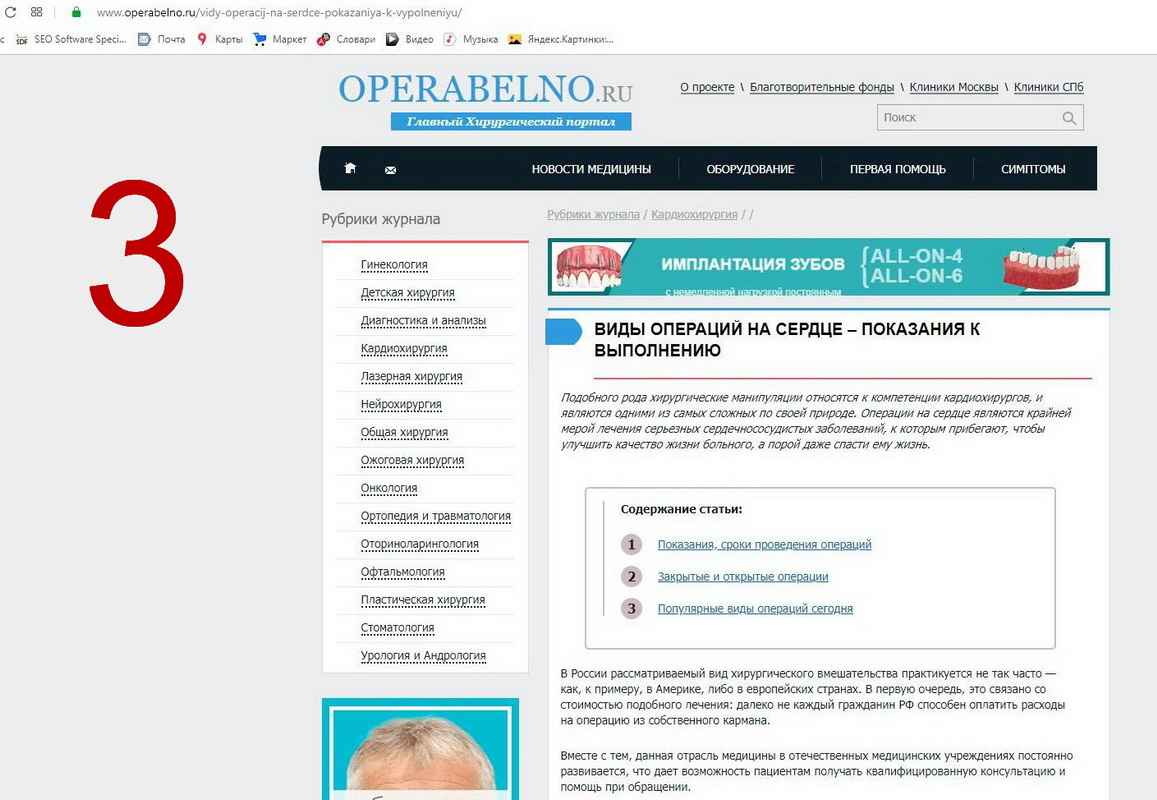 Реклама Яндекс