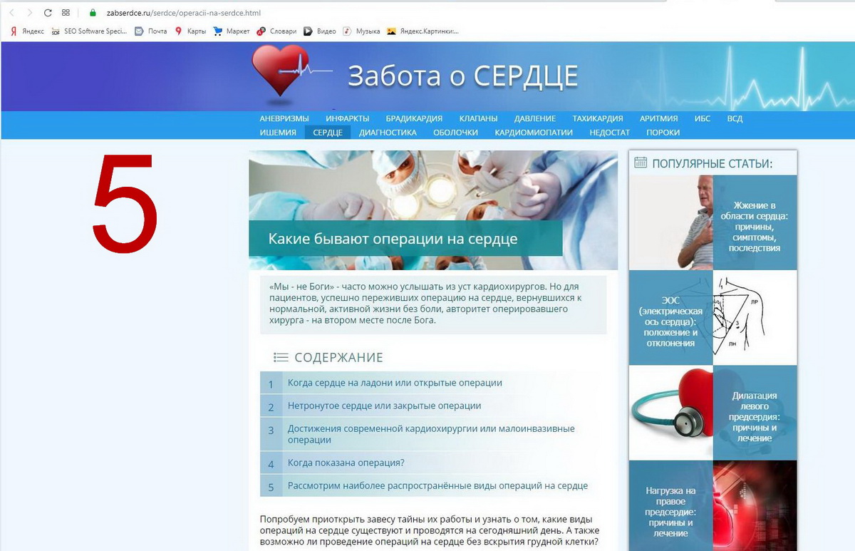 Реклама Яндекс